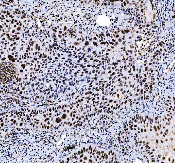 a00325 3 hdac2 primary antibodies ihc testing 4_1