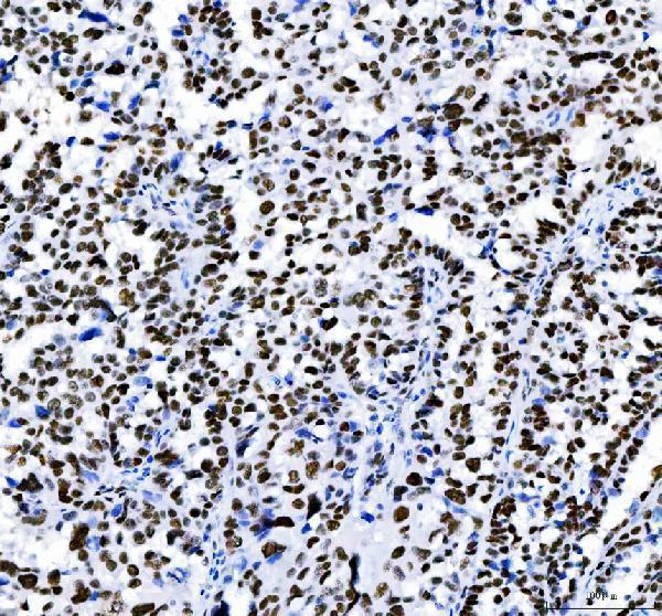 a00325 3 hdac2 primary antibodies ihc testing 5_1