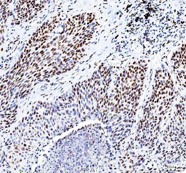 a00325 3 hdac2 primary antibodies ihc testing 6_1