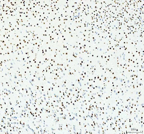 a00325 3 hdac2 primary antibodies ihc testing 7_1