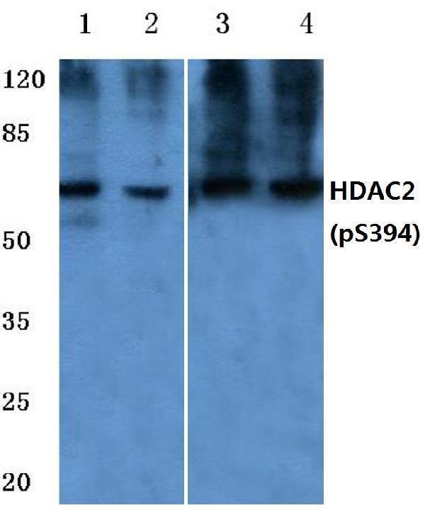 Western blot (WB) analysis of p-HDAC2 (S394) polyclonal antibody at 1:500 dilution
Lane1:HEK293T cell lysate treated with UV
Lane2:PC12 cell lysate treated with UV
Lane3:Mouse kidney tissuel lysate
Lane4:Rat liver tissue lysate