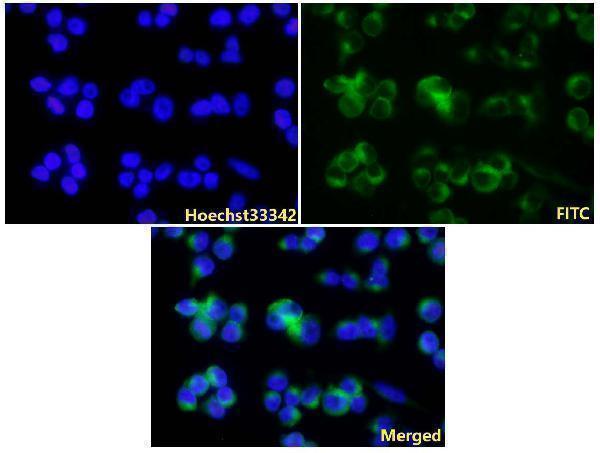 IF image of BS1484 stained A375 cells