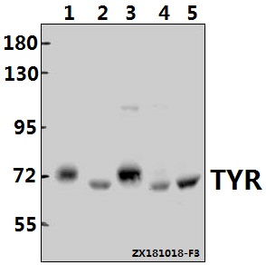 Western blot (WB) analysis of TYR (R501) pAb at 1:500 dilution
Lane1:A375 whole cell lysate(40ug)
Lane2:Podocyte whole cell lysate(40ug)
Lane3:Beas-2B whole cell lysate(40ug)
Lane4:PMVEC whole cell lysate(40ug)
Lane5:BV2 whole cell lysate(40ug)