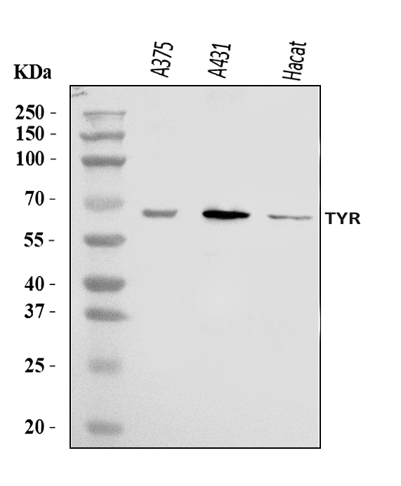  Western blot analysis of Tyrosinase/TYR using anti-Tyrosinase/TYR antibody (A00326-3)