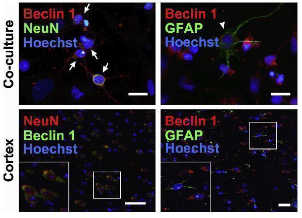 a00327 1 becn1 primary antibodies if testig 11