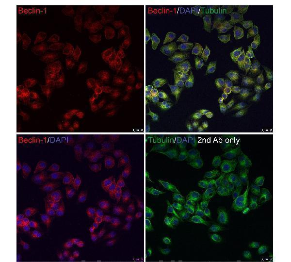 a00327 1 becn1 primary antibodies if testing 1