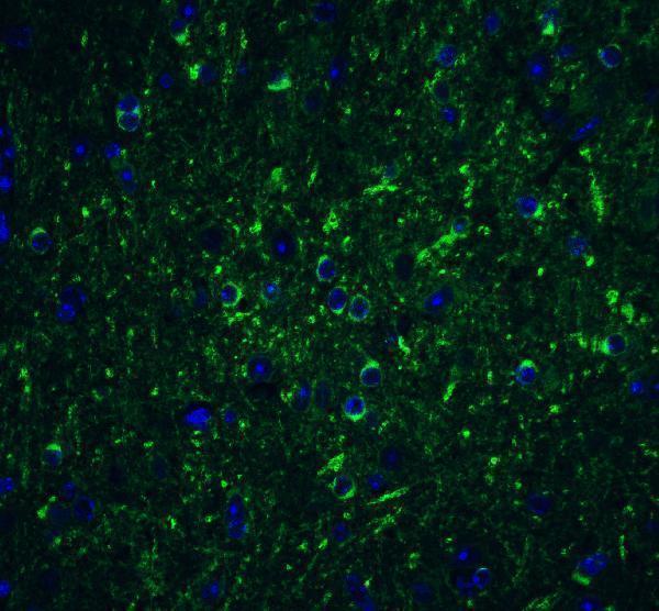 a00327 1 becn1 primary antibodies if testing 9