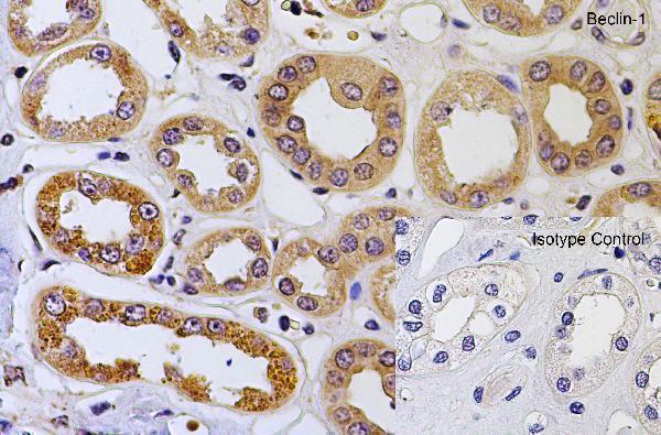 a00327 1 becn1 primary antibodies ihc testing 5