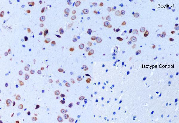 a00327 1 becn1 primary antibodies ihc testing 7