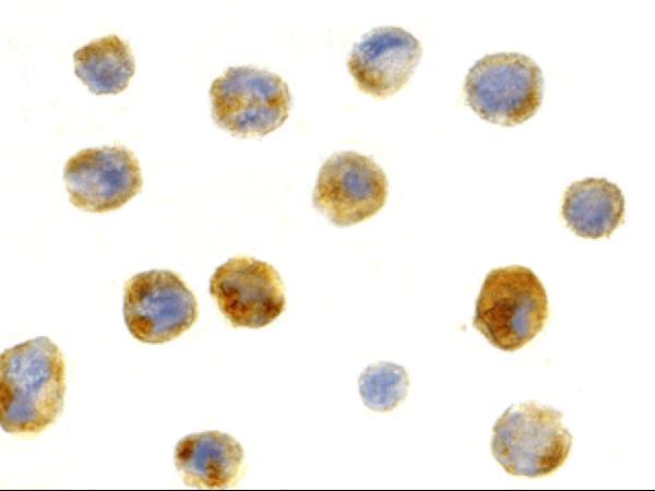 Immunocytochemistry staining of A431 cells using Beclin-1 antibody at 1 μg/mL