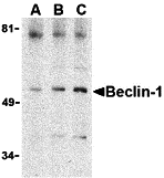 Western blot analysis of Beclin-1 in A431 cell lysate with Beclin-1 antibody at (A) 0