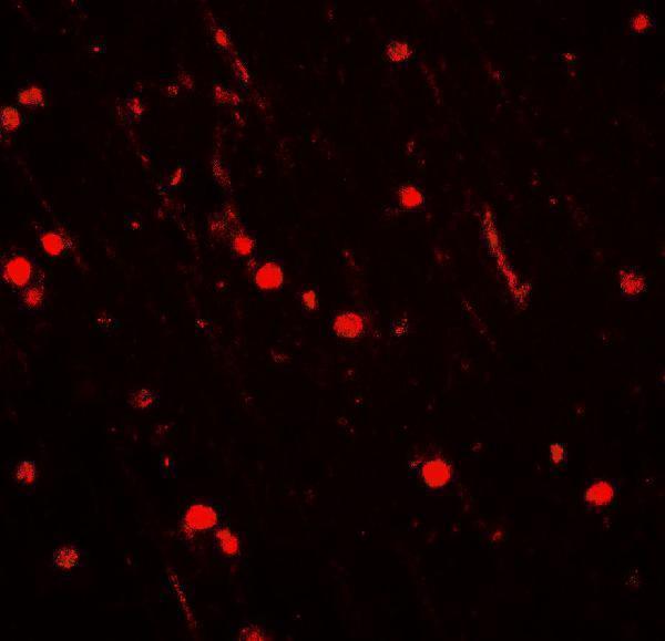 Immunofluorescence of NOX2 in rat brain tissue with NOX2 antibody at 20 μg/ml