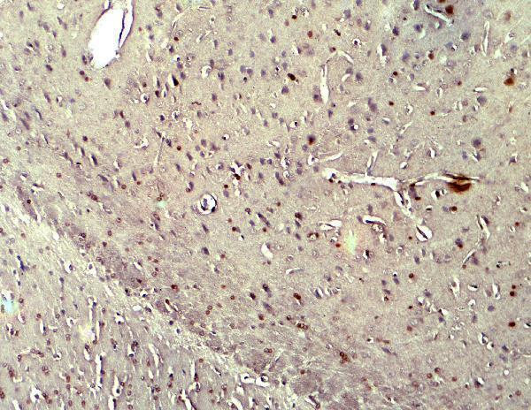 Immunohistochemistry of NOX2 in rat brain tissue with NOX2 antibody at 5 μg/ml