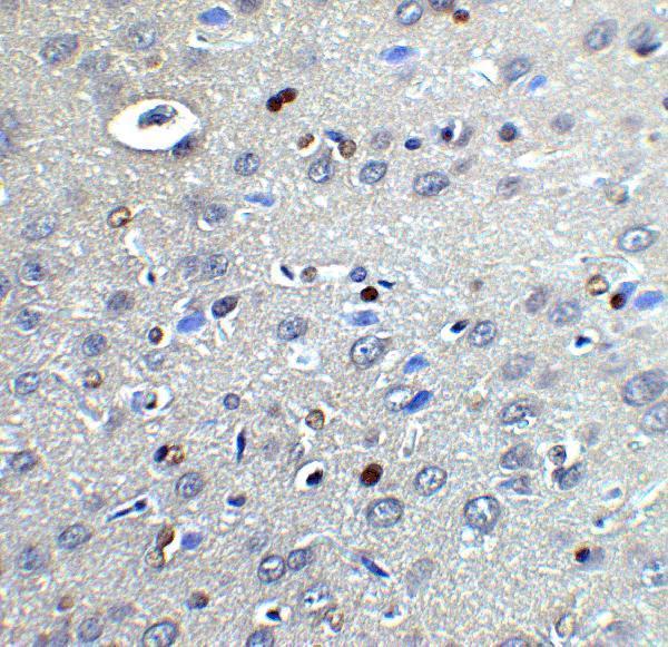 a00328 1 cybb primary antibodies ihc testing 4