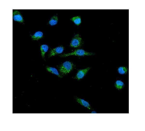 a00328 3 cybb primary antibodies if testing 7