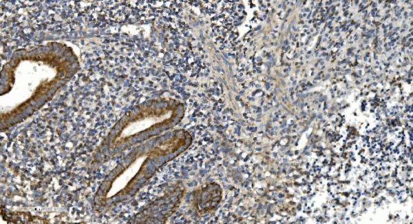  IHC analysis of NOX2/gp91phox/CYBB using anti-NOX2/gp91phox/CYBB antibody (A00328-3)