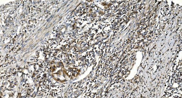  IHC analysis of NOX2/gp91phox/CYBB using anti-NOX2/gp91phox/CYBB antibody (A00328-3)