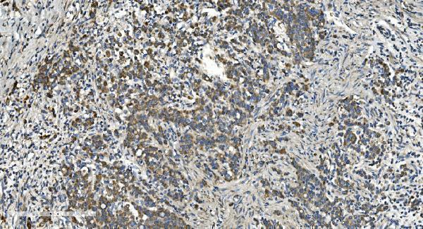 a00328 3 cybb primary antibodies ihc testing 4