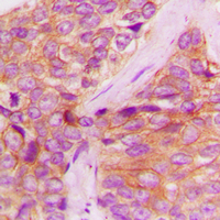 a00330y1022 jak1 primary antiboties ihc testing 2