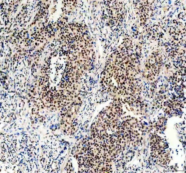 a00331 1 men1 primary antibodies ihc testing 1