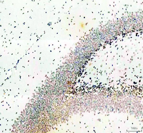 a00331 1 men1 primary antibodies ihc testing 2_1