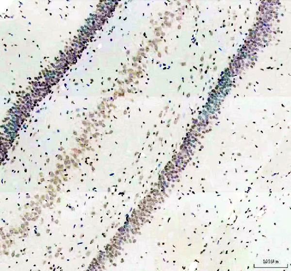 a00331 1 men1 primary antibodies ihc testing 3_1