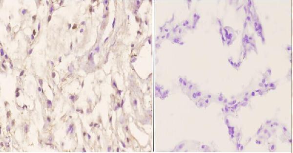 a00331 men1 primary antiboties ihc testing 2