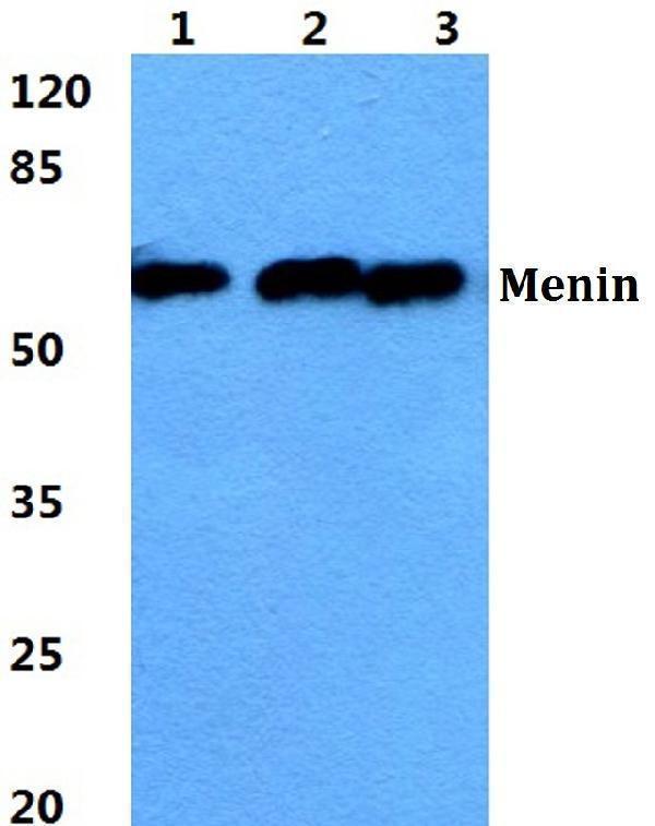 a00331 men1 primary antiboties wb testing 1
