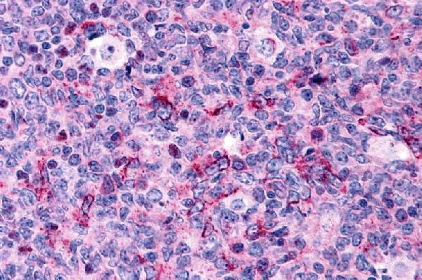 Immunohistochemistry of Caspase-3 in human tonsil tissue with Caspase-3 antibody at 5 μg/mL