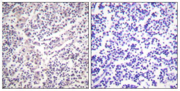 Immunohistochemistry analysis of paraffin-embedded human lymph node, using Caspase 3 (Phospho-Ser150) Antibody