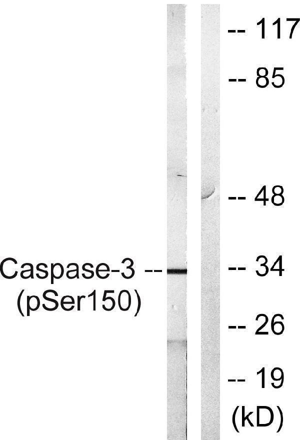 Western blot analysis of lysates from Jurkat cells treated with Etoposide 25uM 60