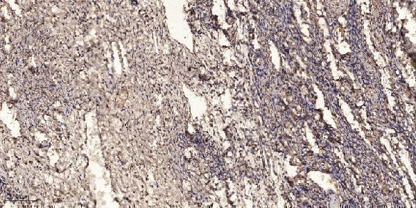 a00336 mthfr primary antibodies ihc testing 1