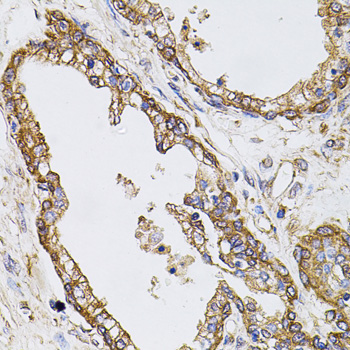 Immunohistochemistry of paraffin-embedded human prostate using CAST antibody  at dilution of 1:100 
