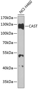 Western blot analysis of extracts of H460 cells, using CAST antibody  at 1:1000 dilution