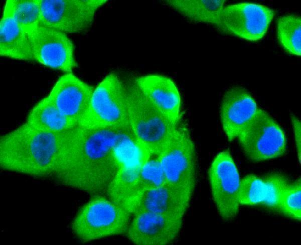 ICC staining Tissue Factor in PANC-1 cells (green)