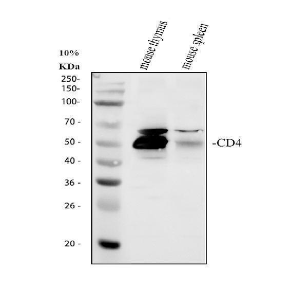 Western blot analysis of CD4 using anti-CD4 antibody (A00344-2)