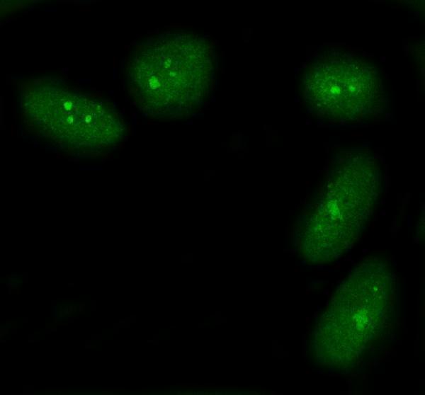 IF analysis of BAP1 using anti-BAP1 antibody (A00345-2)