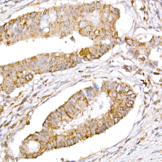 a00346 3 atg7 primary antiboties ihc testing 1