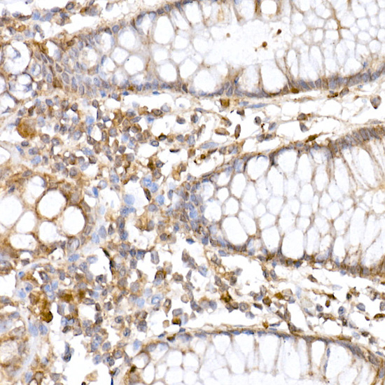 a00346 3 atg7 primary antiboties ihc testing 2