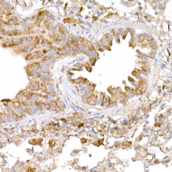 a00346 3 atg7 primary antiboties ihc testing 3
