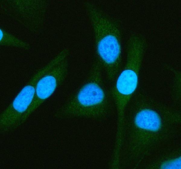 a00346 5 atg7 primary antibodies if testing 7