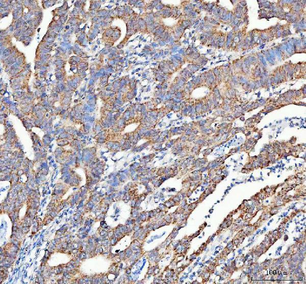 a00346 5 atg7 primary antibodies ihc testing 2