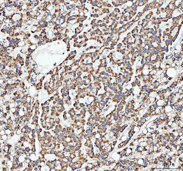 a00346 5 atg7 primary antibodies ihc testing 3
