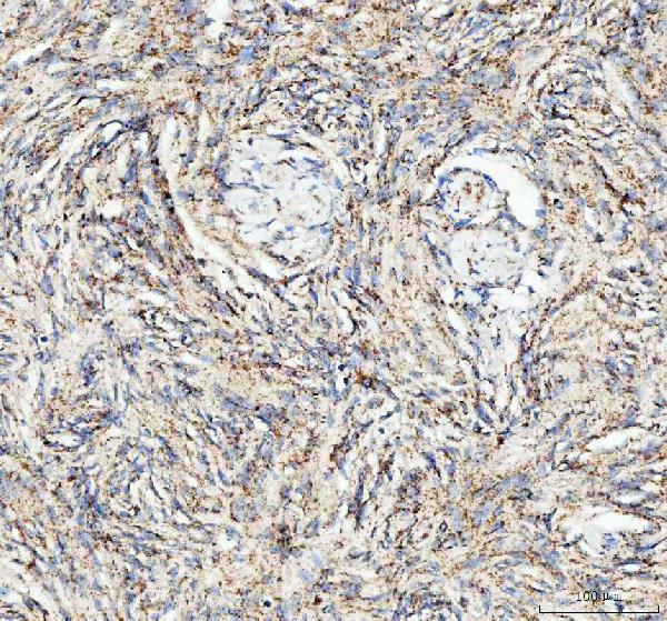 a00346 5 atg7 primary antibodies ihc testing 5