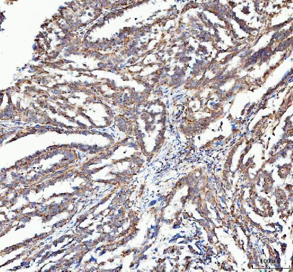a00346 5 atg7 primary antibodies ihc testing 6