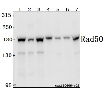 Western blot (WB) analysis of Rad50 (A708) polyclonal antibody at 1:500 dilution
Lane1:786-O whole cell lysate(40ug)
Lane2:U-87MG whole cell lysate(40ug)
Lane3:SGC-7901 whole cell lysate(40ug)
Lane4:SK-OVCAR3 whole cell lysate(40ug)
Lane5:The Testis tissue lysate of Mouse(40ug)
Lane6:The Testis tissue lysate of Rat(40ug)
Lane7:C6 whole cell lysate(40ug)