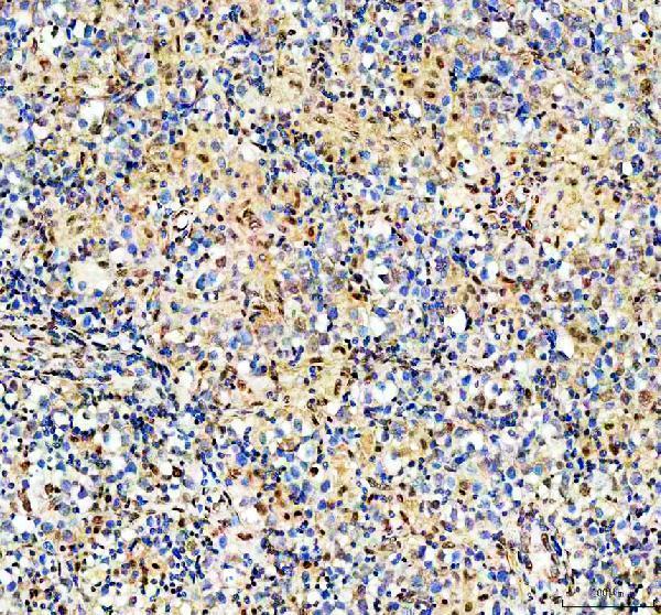 IHC analysis of HRAD50 using anti-RAD50 antibody (A00347-2)