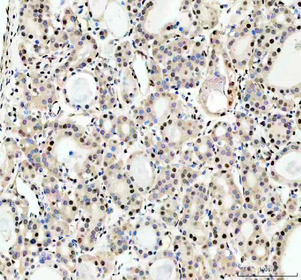 IHC analysis of HRAD50 using anti-RAD50 antibody (A00347-2)