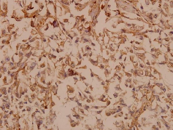 a00348 1 pdgfb primary antiboties ihc testing 2