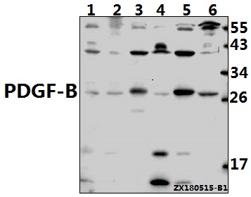 a00348 1 pdgfb primary antiboties wb testing 1